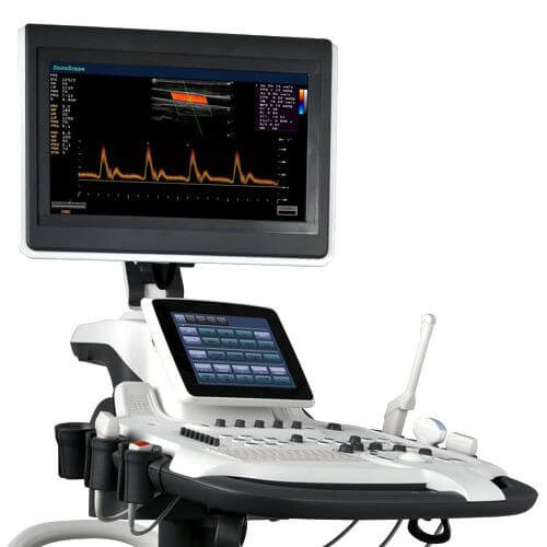 SonoScape S40pro - фото - 12